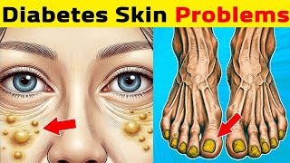 12 Diabetic Skin Signs & Problems You Shouldn't Ignore! | Wikiaware