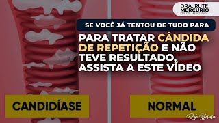 Se você já tentou de tudo para tratar cândida de repetição e não teve resultado, assista este vídeo.