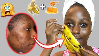 Maajabu ya NDIZI kutoa CHUNUSI | Banana peel & cornstarch will make you younger no matter your age