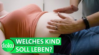 Bluttest vor der Geburt - Schwanger mit behindertem Kind | WDR Doku