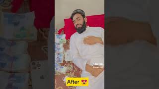 Umar_920 Before 😥 and After 🤩 Mashallah #viralvideo #youtubeshorts #shortvideo #umar920