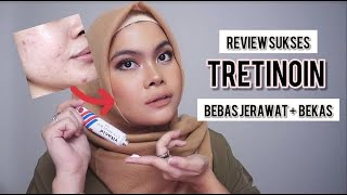 Obat Jerawat Ampuh #3: Tretinoin/Vitacid | Review 3 Tahun