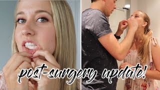 POST-SURGERY WITH TYPE 1 DIABETES + Q&A // type 1 diabetes day in the life