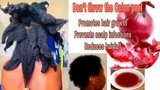 How to : Your hair won't stop growing with Onion peels #simplychisom #diy #naturalhair