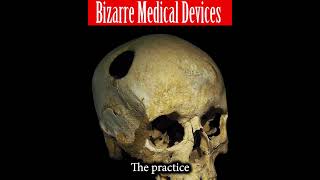 5  Bizarre Medical Devices