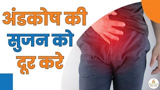 अंडकोष की सुजन और दर्द को 1 हफ्ते में खत्म करने का आसान इलाज | Andkosh Ki Sujan Kaise Theek Kare