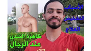 ظاهرة التثدي عند الرجال (اسباب، اعراض، تشخيص، علاج)