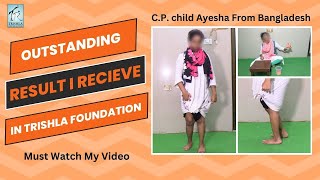 Dystonic Cerebral Palsy Video :  Bangladeshi Girl with Dystonic CP Walking | Trishla Foundation