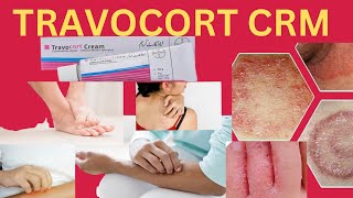 Travocort cream ! How to use travocort cream ! Fungal infection travocort cream .