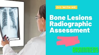 Bone Lesions Radiographic Assessment Part 1 by Geoffrey Riley X Ray