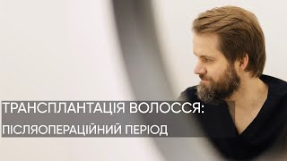 РЕКОМЕНДАЦІЇ ПІСЛЯ ПЕРЕСАДКИ ВОЛОССЯ