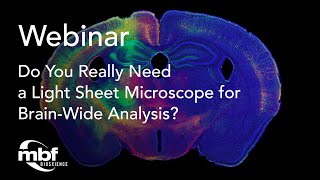 Do You Really Need a Light Sheet Microscope for Brain-Wide Analysis?