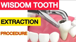 Wisdom Tooth Extraction: What Happens When You Remove Your Wisdom Tooth