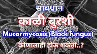 सावधान; काळी बुरशी (Mucormycosis-Black fungus)कोणालाही होऊ शकतो.|| #star_माझा #Mucormycosis