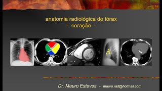 Anatomia - Coração