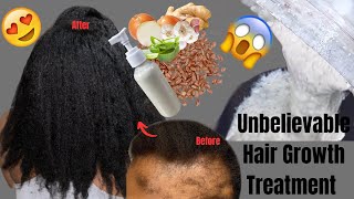 Unbelievable Hair Growth Treatment! Your Hair Will grow Faster & Thicker.