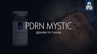 PDRN MYSTIC. Дренаж по точкам