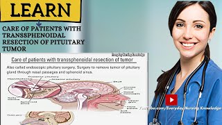 Care Of Patients with transsphenoidal resection of pituitary tumor I Everyday Nursing Knowledge