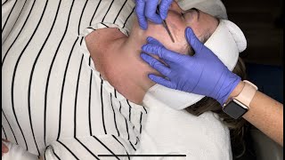 Dermaplane Facial - Hale & Hush - Preston Rxtractor - Ashley Aesthetics