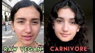 Raw Vegan Diets Are Unhealthy! | My Experience