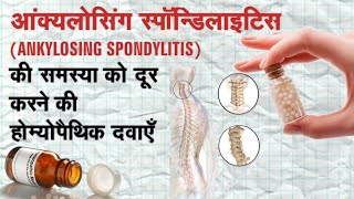 Hlab27 Homeopathic medicine symptoms | Ankylosing Spondylitis | Natural remedies | होम्योपैथिक उपचार