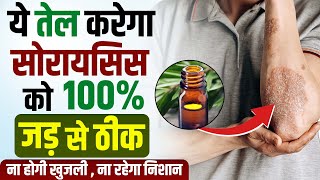 ये तेल करेगा सोरायसिस को 100% ठीक | ✅ 100% Recovery From Psoriasis Treatment | Psoriasis ka ilaj