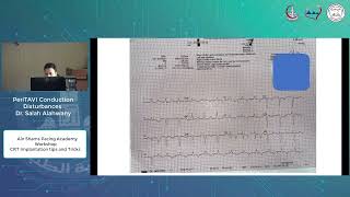 PeriTAVI Conduction Disturbances  - Dr.  SALAH ALAHWANY