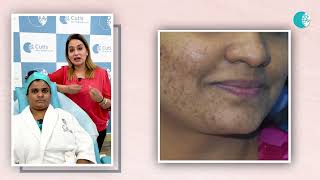 Using fairness creams can be harmful | Dr Apratim Goel has explained why | Cutis Skin Solution