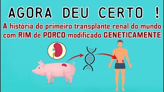 Pelo FIM da DIÁLISE: XENOTRANSPLANTE é a Nova APOSTA !