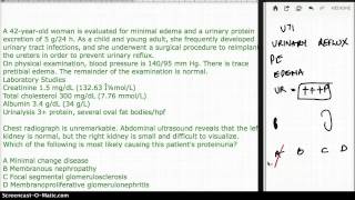 517 FOCAL SEGMENTAL VS MGN