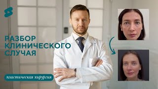 Новости нашей пациентки: как же она выглядит после реабилитации?  Продолжение популярного видео.