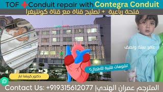 فتحة رباعية و تصليح قناة مع قناة كونتيغرا |TOF + Conduit repair with Contegra Conduit| مستشفى فورتس