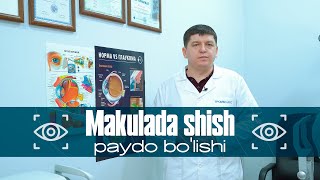 Makulada shish paydo bo'lsa | Dr.zohidjon