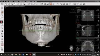 Tutorial EZ3D i Vatech