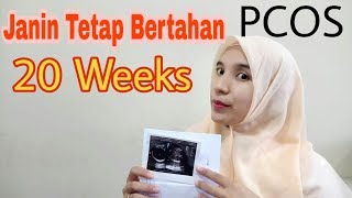 PCOS - Hamil ke 5x (Janin Tetap Bertahan 5 Bulan)