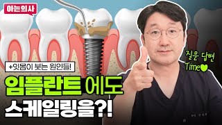 임플란트 수술 후 스케일링 받을 수 있을까요? +잇몸이 자주 붓는 이유