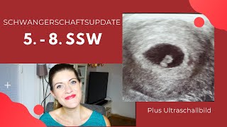 Schwangerschaftsupdate 5. - 8. SSW | Übelkeit, Erschöpfung - Ladieh Tieytsch