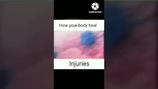 How your body heal injuries | #science #biology #injury