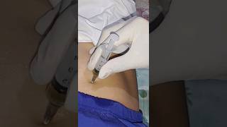 injection into the gluteal muscle. intramuscular injection #injection #intramuscular #intramuscular