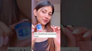 Blackhead removal😍 #blackheadremoval#ytshorts#shorts#diyhacks#lifehacks#blackheads#vaselinehacks