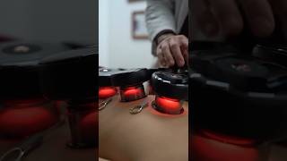 Smart cupping with red light therapy. #achedaway #massagetherapy #cuppingtherapy