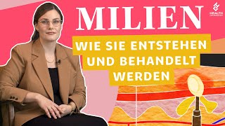 Milien: Wie man sie erkennt und behandelt | Health Celerates