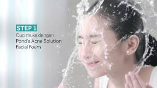 Pond's Acne Solution (dircut)