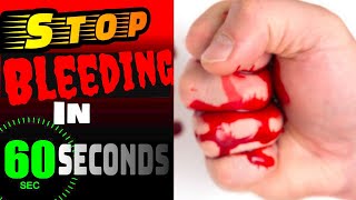 how to stop blood fast | Khun kaise band kare | how to stop blood fast home remedies in hindi |