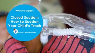 Closed Suction: How to Suction Your Child’s Trach