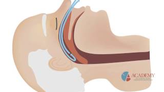 Predictors and Health Risks Associated With OSA, With Dr  Larry Pribyl, of the Center for TMJ & Slee