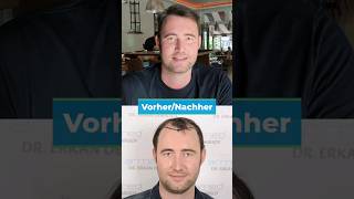 Haartransplantation Türkei mit Dr. Erkan Demirsoy [Vorher Nachher] #haartransplantationtürkei