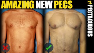 Pec Implants in NYC and LA - Male Plastic Surgery