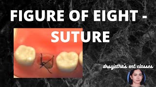 099.Skill Learning in Medicine : Figure of Eight Suture  #figureofeight  #suture #surgeryeducation