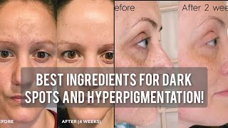 Best Ingredients For Dark Spots And Hyperpigmentation #shorts